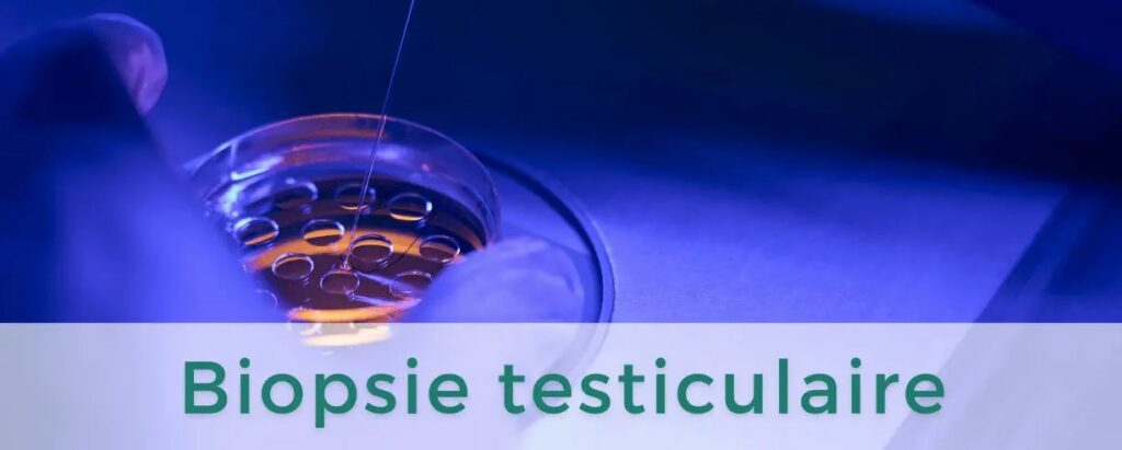 Biopsie testiculaire