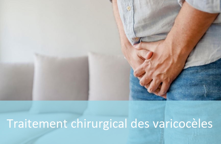 Traitement chirurgical des varicocèles